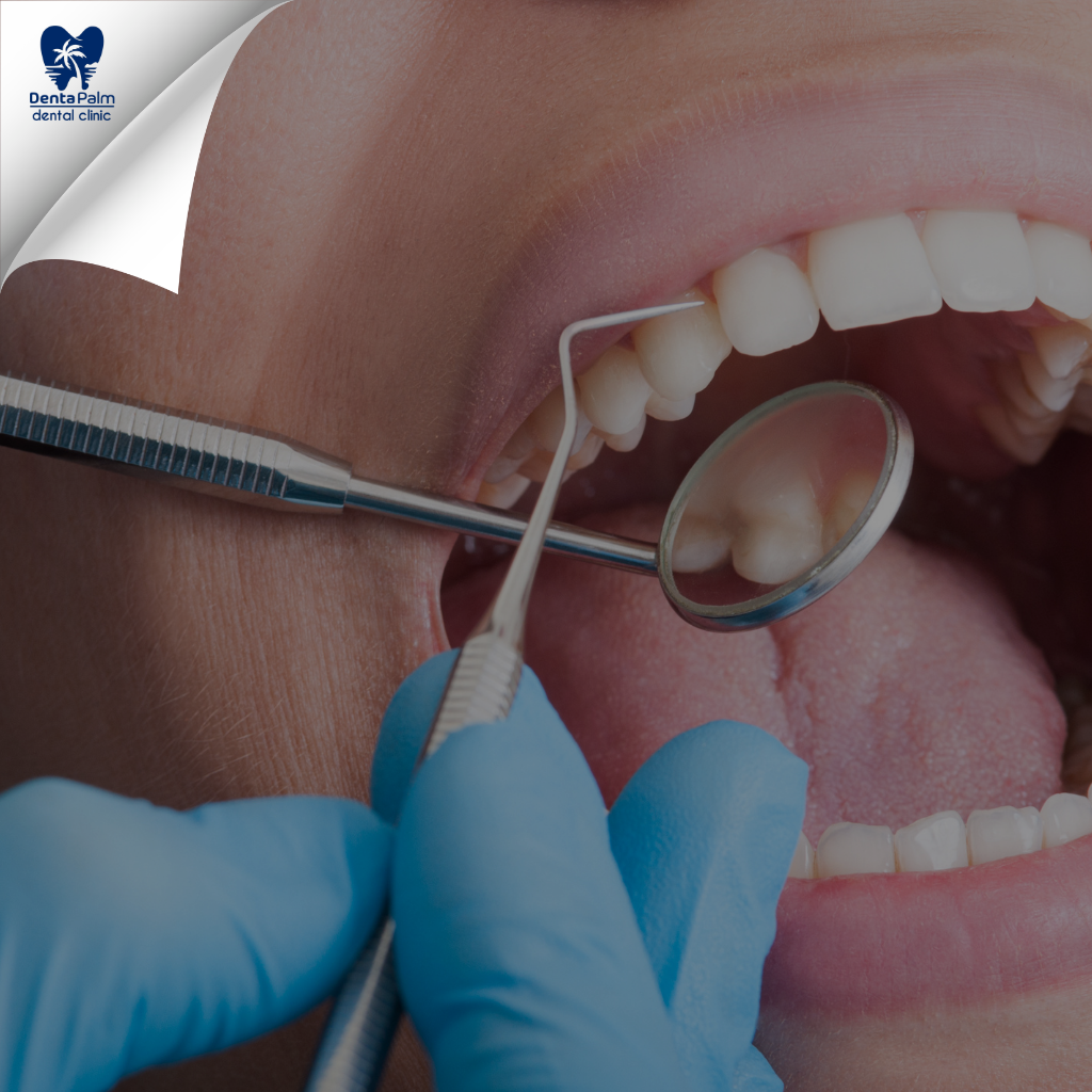 Discover Quality Dental Care at Dentapalm, Alanya